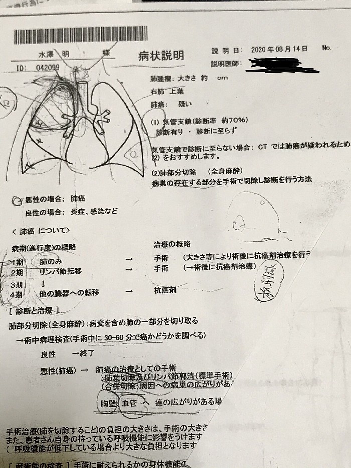 がん告知ー腫瘍及び治療説明